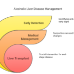 Alcoholic Liver Disease