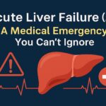 Acute Liver failure