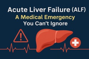 Acute Liver failure